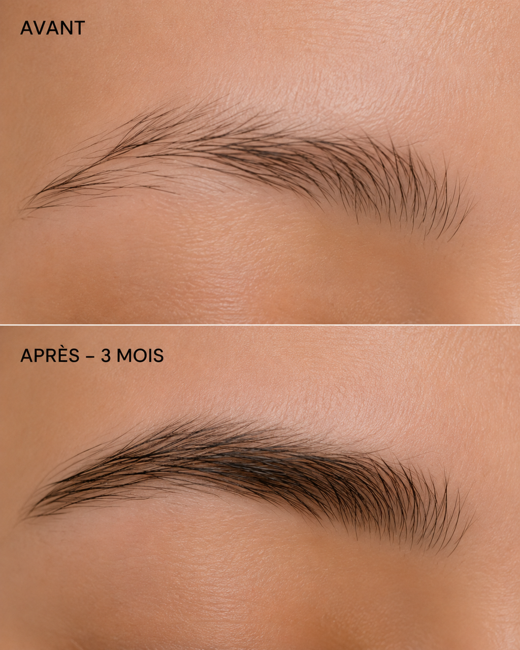 Sérum - SOURCILS